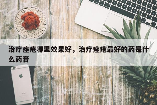治疗痤疮哪里效果好,治疗痤疮最好的药是什么药膏