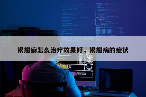 银翘癣怎么治疗效果好,银翘病的症状