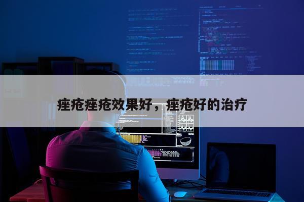 痤疮痤疮效果好,痤疮好的治疗